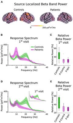 Bilaterally Reduced Rolandic Beta Band Activity in Minor Stroke Patients